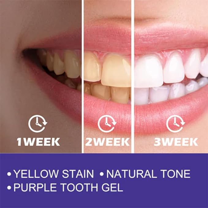 Whitening Foam Toothpaste